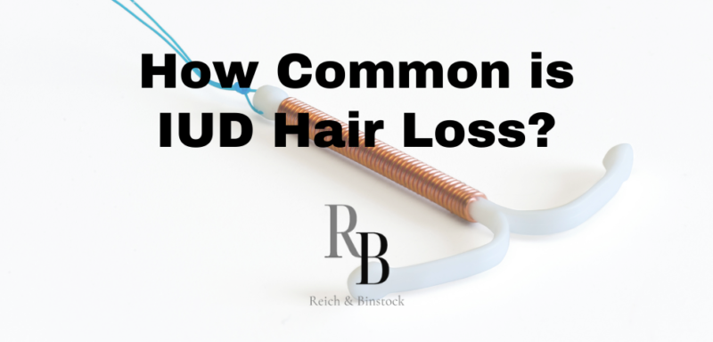 IUD Hair Loss