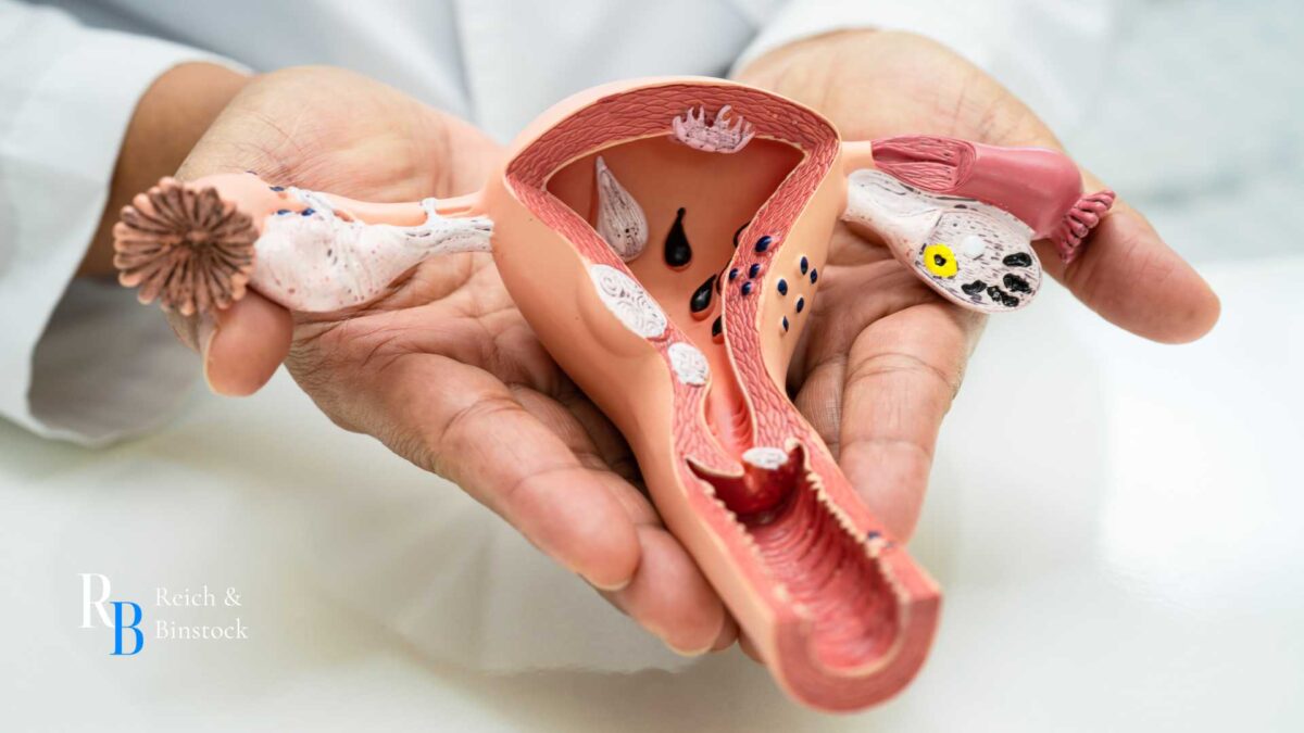 uterine perforation symptoms iud