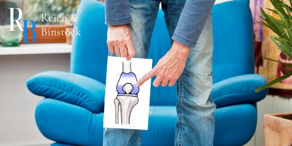 exactech knee implant cases