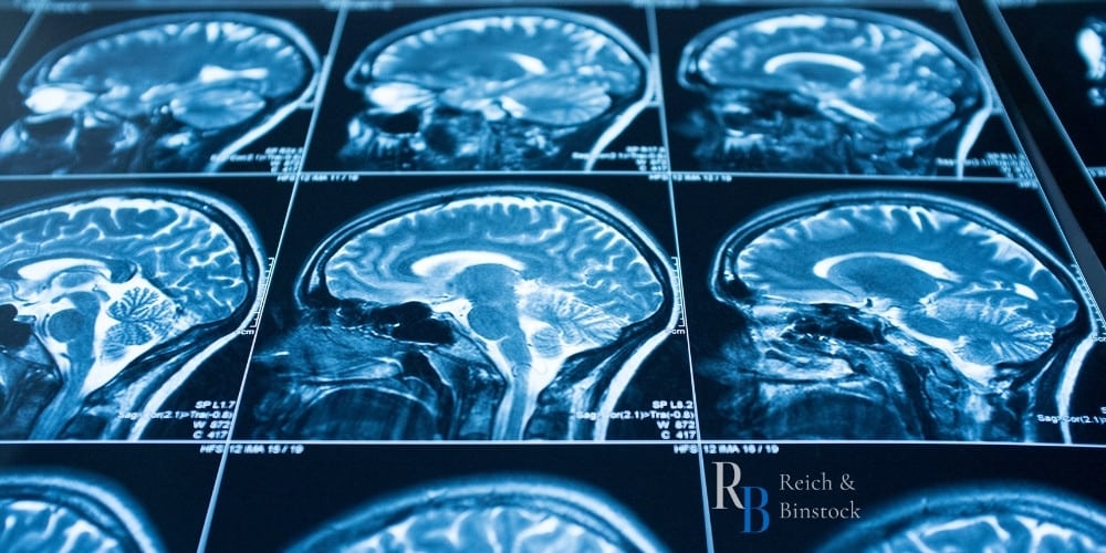 Houston head injury lawyer