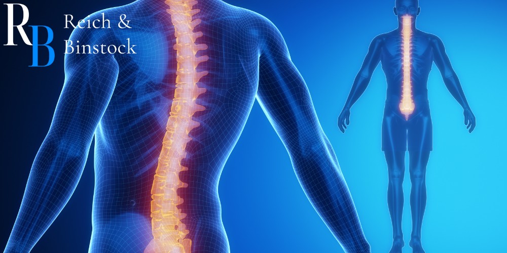 houston spinal cord injury attorneys