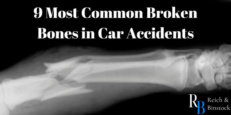 most common broken bones in car accidents