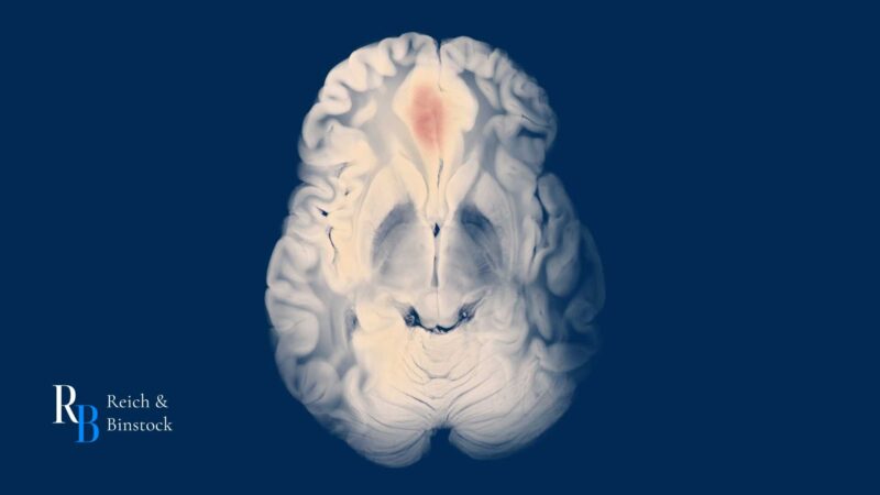 Symptoms of Brain Bleed After Hitting Head